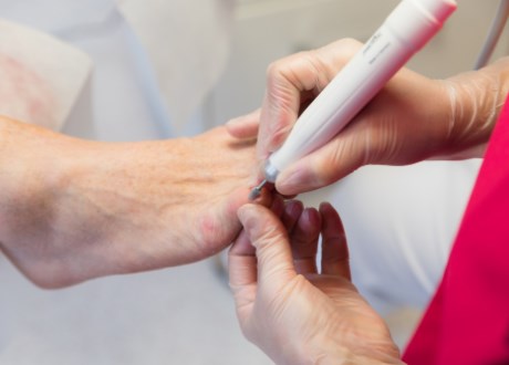 behandling mot liktorn behandling mot liktorn