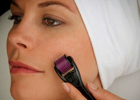 laser beauty way linköping laser beauty way linköping